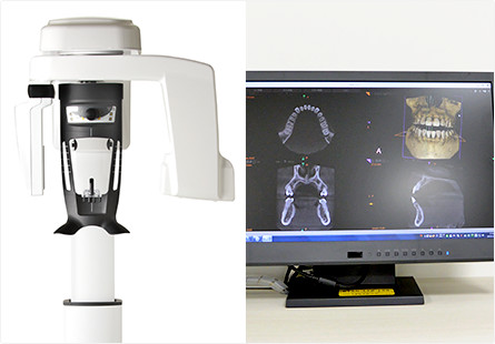歯科用CT