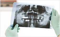 口腔内検査、レントゲン撮影