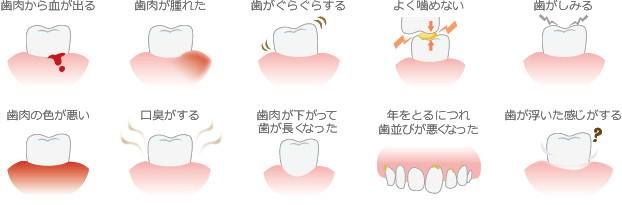 歯周病の症状